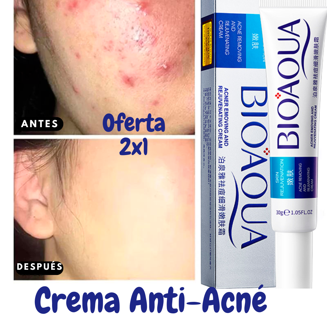 (2X1) Crema Anti Acné "Bioaqua"