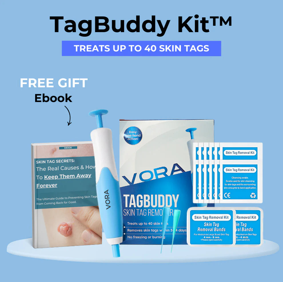 Kit TagBuddy: No más verrugas en la piel