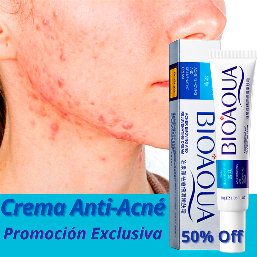 (2X1) Crema Anti Acné "Bioaqua"