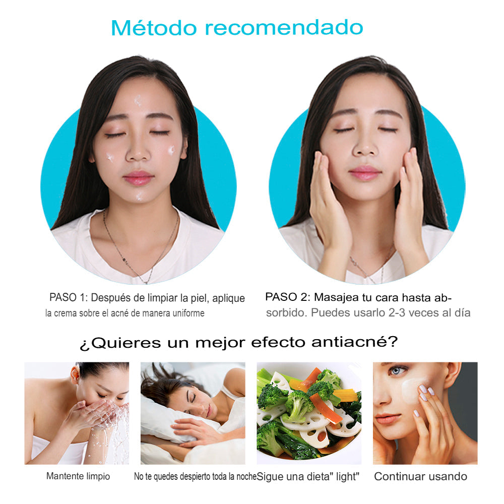 (2X1) Crema Anti Acné "Bioaqua"