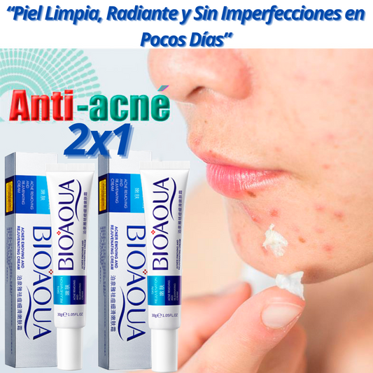 (2X1) Crema Anti Acné "Bioaqua"
